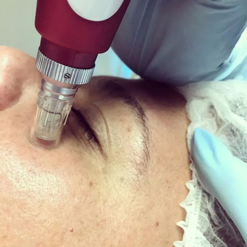 Dermapen